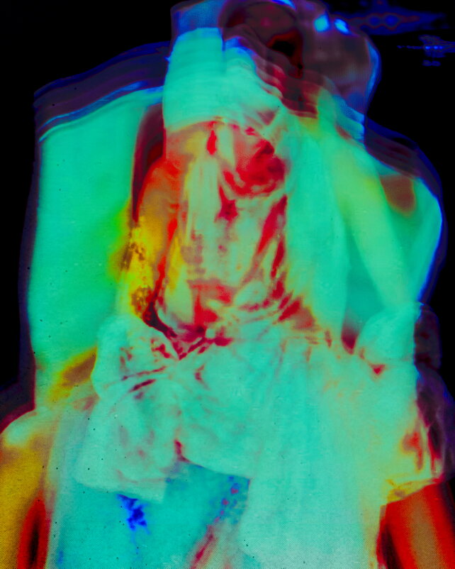 ТВ Кадры - Денис Безногов